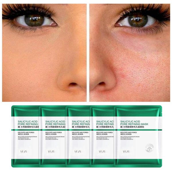 ماسک صورت وزه مدل سالیسیلیک اسید ضد جوش وزن 25 گرم بسته 5 عددی