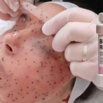 ماسک هیدروژلی هیالورونیک اسید 650 گرمی HYALURONIC ACID ساخت چین