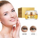 ژل آبرسان دور چشم حلزون طلا ونزن Venzen | پخش عمده